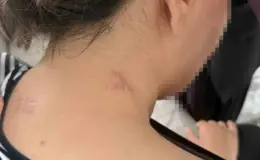 Ölü Taklidiyle Hayata Tutunan Anne