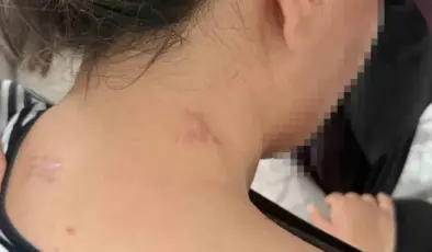 Ölü Taklidiyle Hayata Tutunan Anne