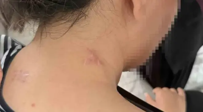 Ölü Taklidiyle Hayata Tutunan Anne