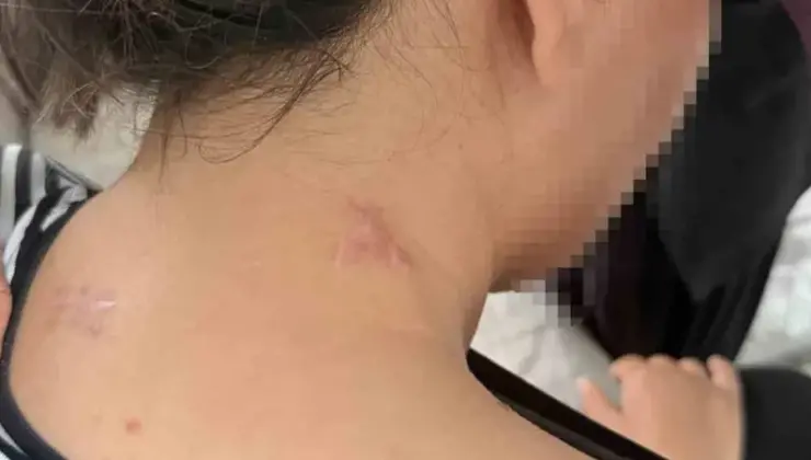 Ölü Taklidiyle Hayata Tutunan Anne